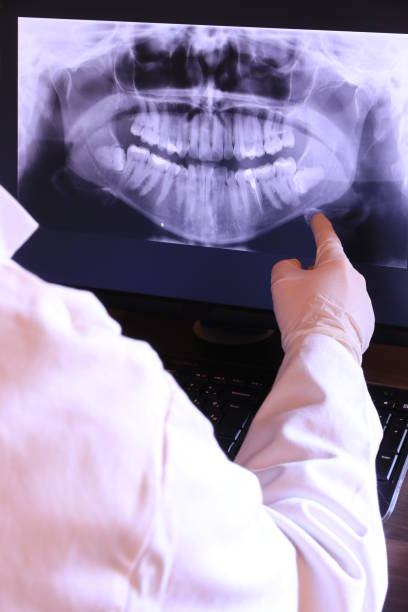 Best Emergency Denture Repair in Ponchatou, LA